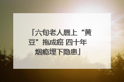 六旬老人唇上“黄豆”拖成癌 四十年烟瘾埋下隐患